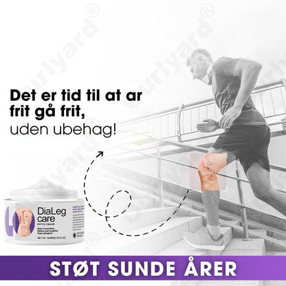 DiaLeg Care™ – Phyto-creme mod åreknuder, hævelse og bensmerter