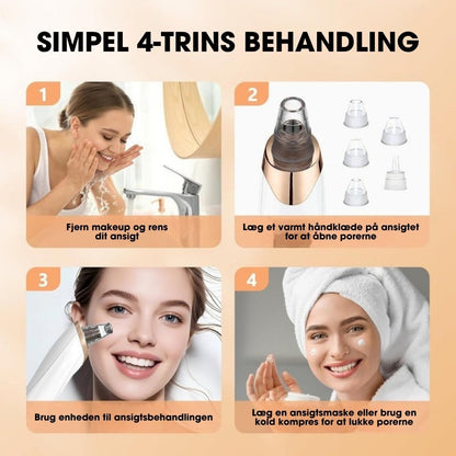 PorePro™ – 6-i-1 pore-renser med justerbart sug og udtræksværktøj