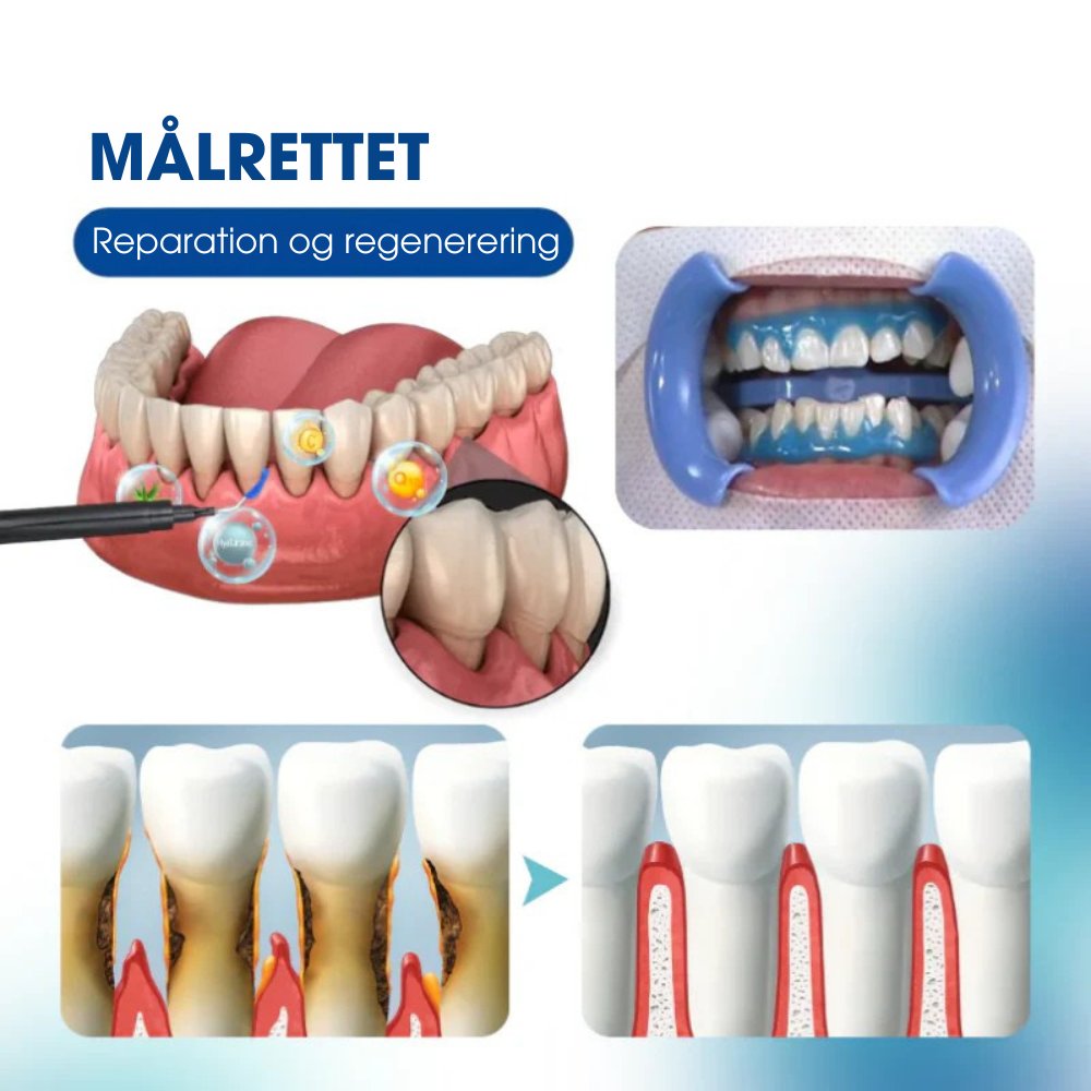 GummCare™ – Naturlig tandkødsplejende essens