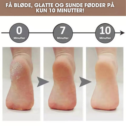 CalluCare™ - Elektrisk eeltfjerner