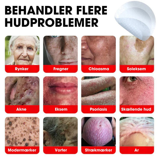 BotaniClear™ – Microneedle-patch til hudflapper - 1+1 GRATIS