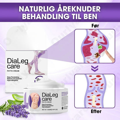 DiaLeg Care™ – Phyto-creme mod åreknuder, hævelse og bensmerter